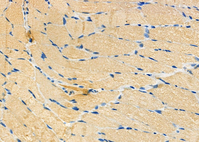 Urotensin II Receptor Antibody in Immunohistochemistry (Paraffin) (IHC (P))