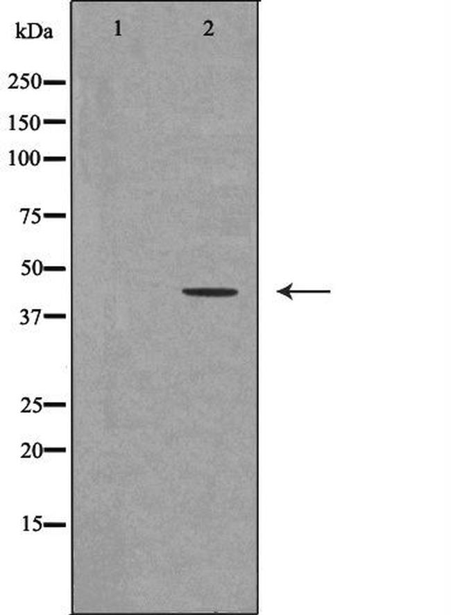 Urotensin II Receptor Antibody in Western Blot (WB)