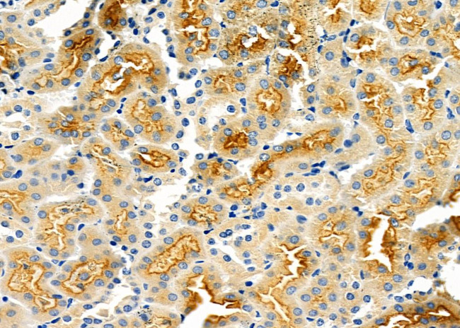 ABCA6 Antibody in Immunohistochemistry (Paraffin) (IHC (P))