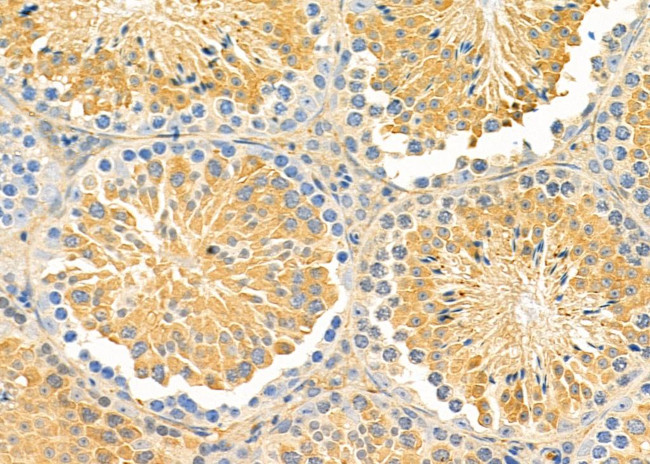 ABCA6 Antibody in Immunohistochemistry (Paraffin) (IHC (P))