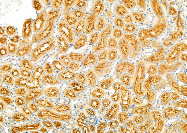 ABCA6 Antibody in Immunohistochemistry (Paraffin) (IHC (P))