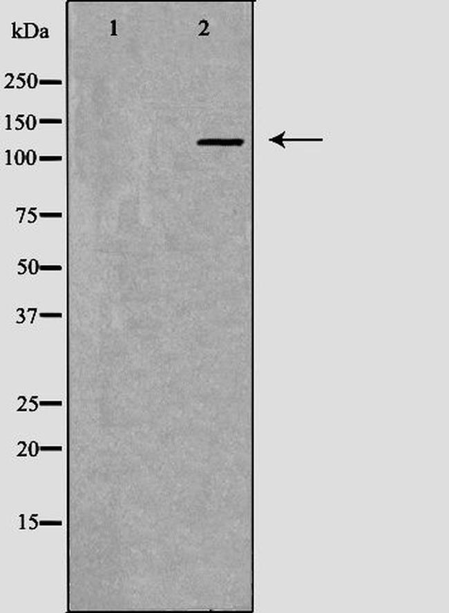 MSH3 Antibody in Western Blot (WB)