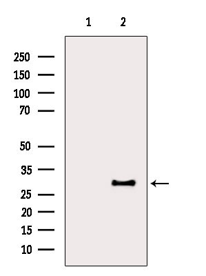 LAT Antibody in Western Blot (WB)