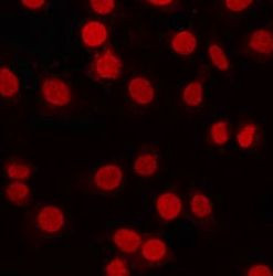 T-bet Antibody in Immunocytochemistry (ICC/IF)