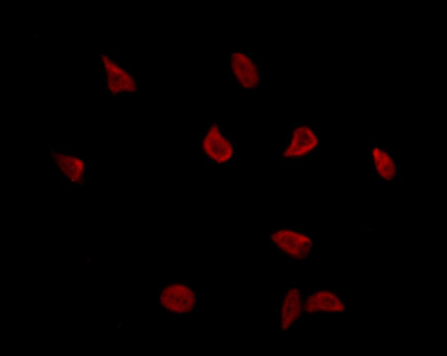 T-bet Antibody in Immunocytochemistry (ICC/IF)