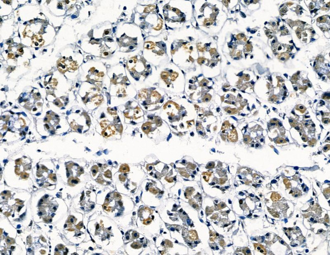 Galectin 4 Antibody in Immunohistochemistry (Paraffin) (IHC (P))