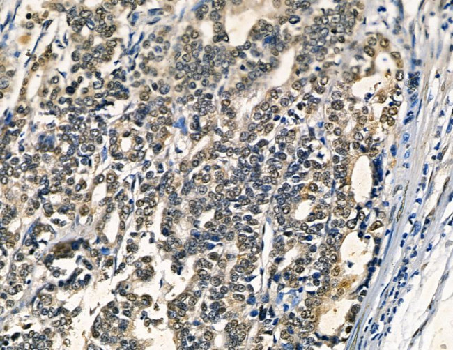 Galectin 4 Antibody in Immunohistochemistry (Paraffin) (IHC (P))