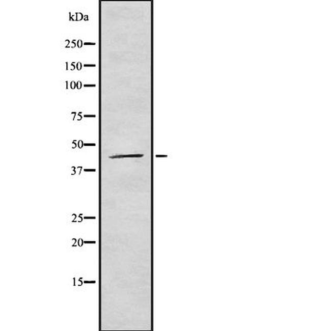 Varicella zoster Virus (strain Dumas) Antibody in Western Blot (WB)