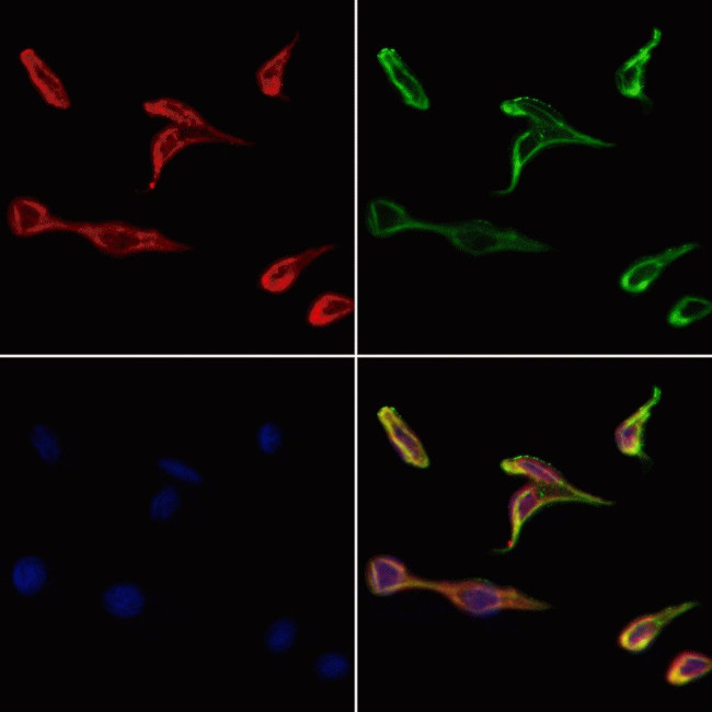 RNF6 Antibody in Immunocytochemistry (ICC/IF)