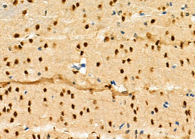 RNF6 Antibody in Immunohistochemistry (Paraffin) (IHC (P))