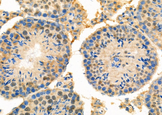 RNF6 Antibody in Immunohistochemistry (Paraffin) (IHC (P))