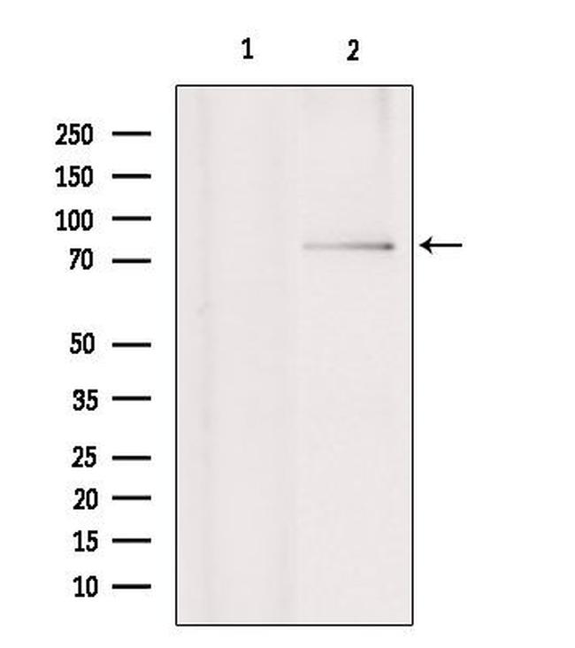 RNF6 Antibody in Western Blot (WB)