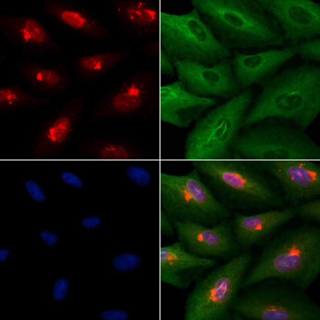 BAF53B Antibody in Immunocytochemistry (ICC/IF)