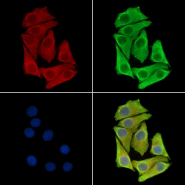 ETNPPL Isoform 1 Antibody in Immunocytochemistry (ICC/IF)