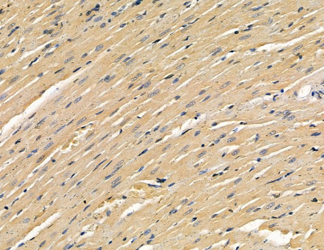 TOP1MT Antibody in Immunohistochemistry (Paraffin) (IHC (P))