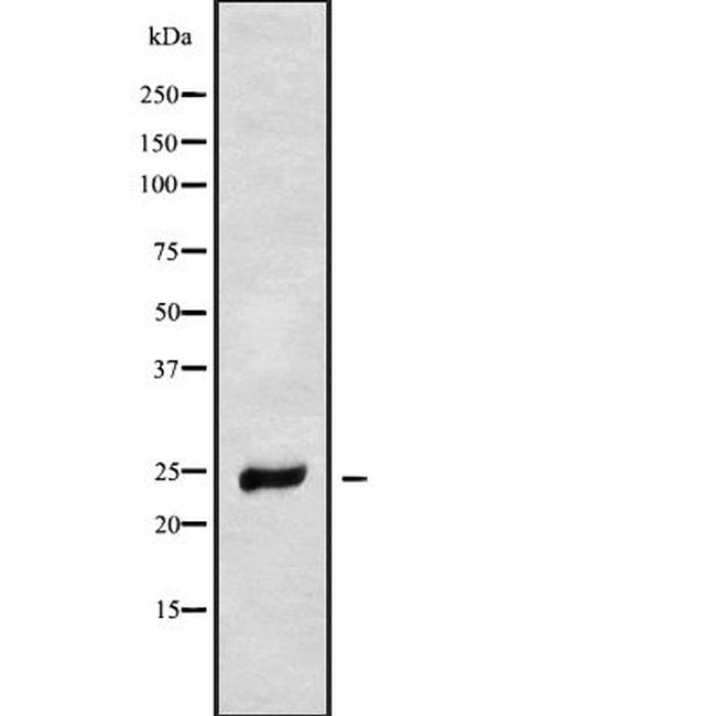 NDUFS8 Antibody in Western Blot (WB)