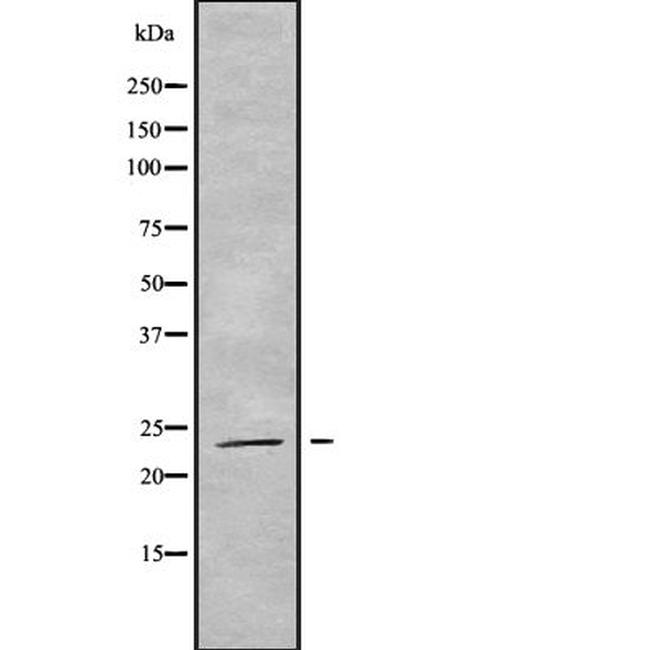 RAB19 Antibody in Western Blot (WB)