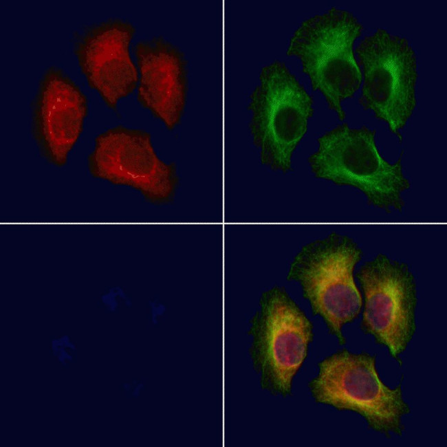 TRAPPC1 Antibody in Immunocytochemistry (ICC/IF)