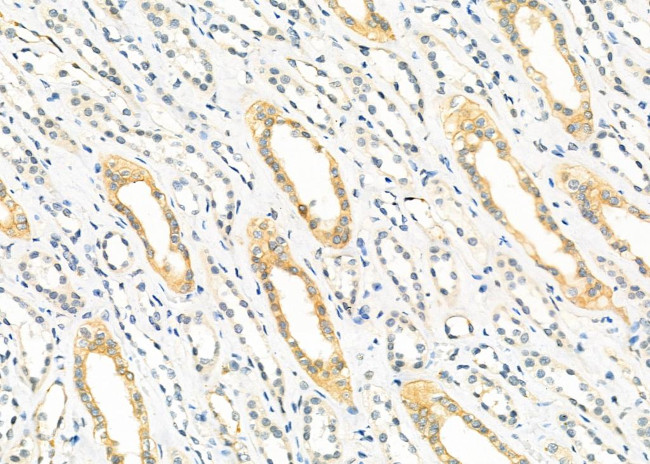 TRAPPC1 Antibody in Immunohistochemistry (Paraffin) (IHC (P))