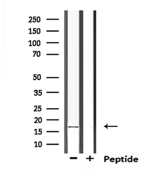 TRAPPC1 Antibody in Western Blot (WB)