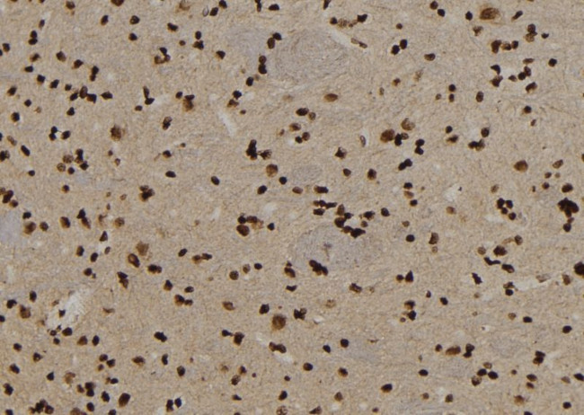 USP29 Antibody in Immunohistochemistry (Paraffin) (IHC (P))