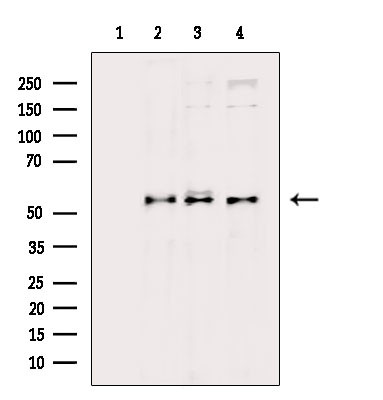 Phospho-AKT1/AKT2/AKT3 (Ser473) Antibody in Western Blot (WB)