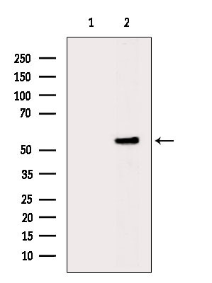 Phospho-AKT1/AKT2/AKT3 (Ser473) Antibody in Western Blot (WB)
