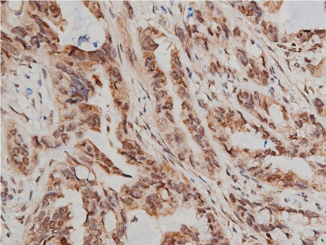 Phospho-AKT1/AKT2/AKT3 (Ser473) Antibody in Immunohistochemistry (Paraffin) (IHC (P))