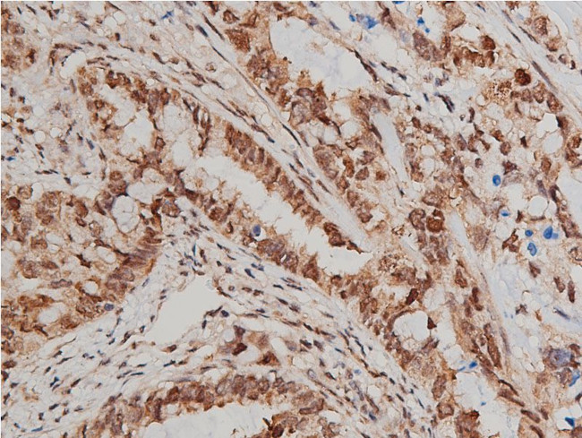 Phospho-AKT1/AKT2/AKT3 (Ser473) Antibody in Immunohistochemistry (Paraffin) (IHC (P))