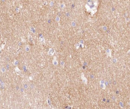 Factor VIII Antibody in Immunohistochemistry (Paraffin) (IHC (P))