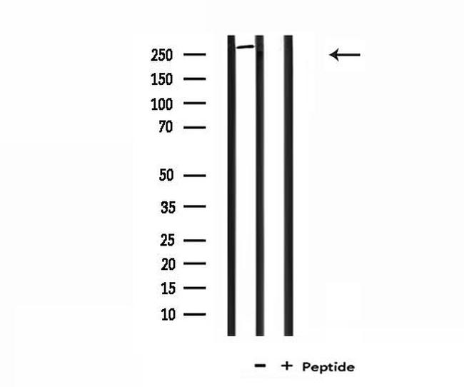 Factor VIII Antibody in Western Blot (WB)