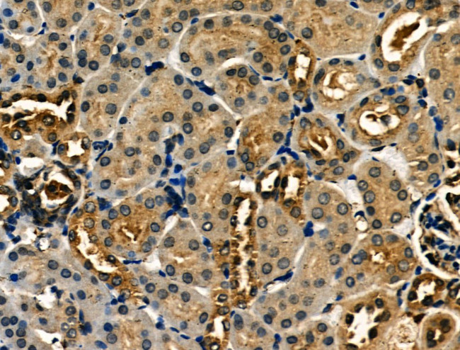 Involucrin Antibody in Immunohistochemistry (Paraffin) (IHC (P))