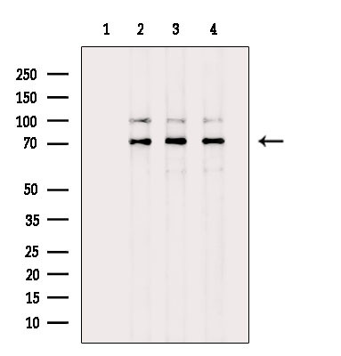 Involucrin Antibody in Western Blot (WB)