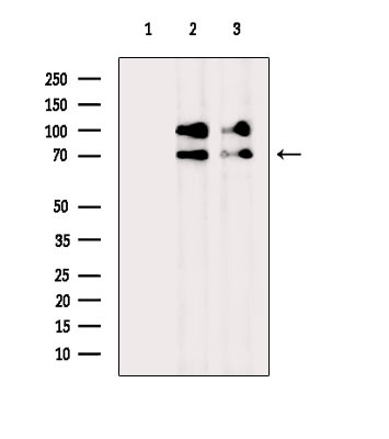 Involucrin Antibody in Western Blot (WB)