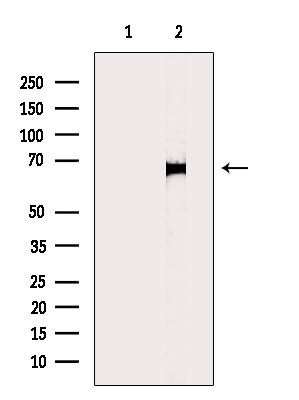 Involucrin Antibody in Western Blot (WB)