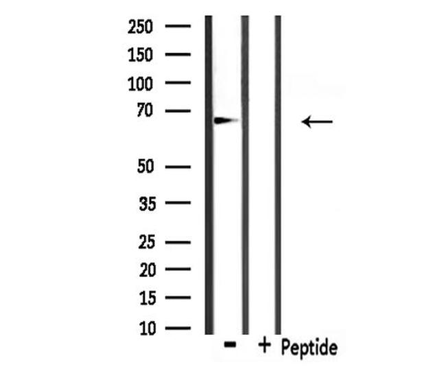 Involucrin Antibody in Western Blot (WB)