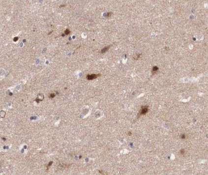 JM4 Antibody in Immunohistochemistry (Paraffin) (IHC (P))