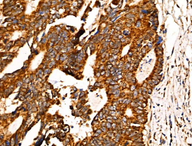 JM4 Antibody in Immunohistochemistry (Paraffin) (IHC (P))