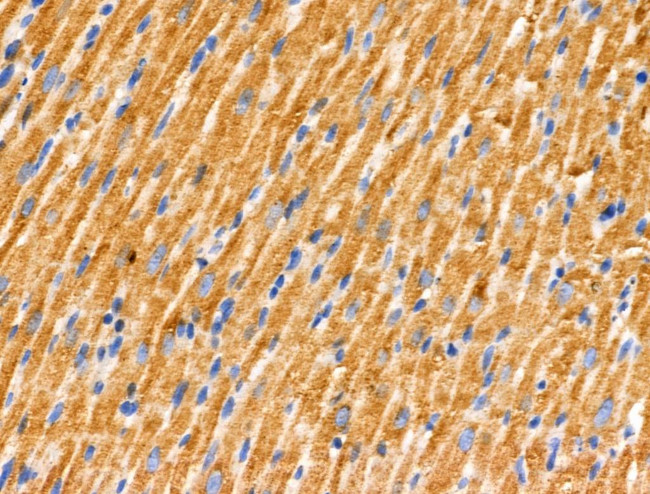 JM4 Antibody in Immunohistochemistry (Paraffin) (IHC (P))