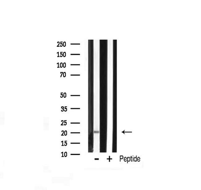 JM4 Antibody in Western Blot (WB)