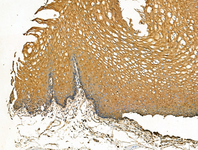 Cytokeratin 10 Antibody in Immunohistochemistry (Paraffin) (IHC (P))