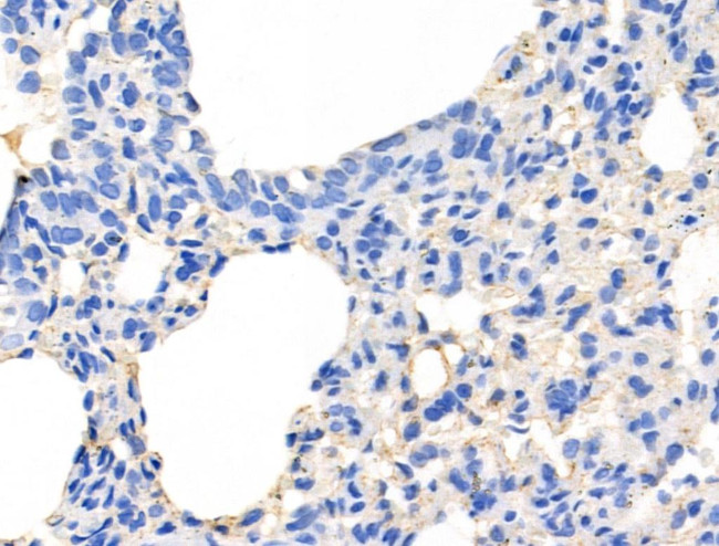 Mammaglobin A Antibody in Immunohistochemistry (Paraffin) (IHC (P))