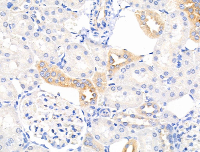 Mammaglobin A Antibody in Immunohistochemistry (Paraffin) (IHC (P))