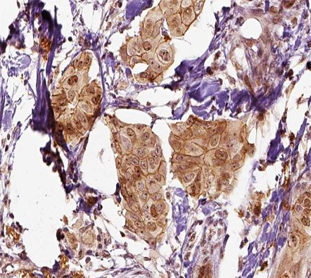 Mammaglobin A Antibody in Immunohistochemistry (Paraffin) (IHC (P))