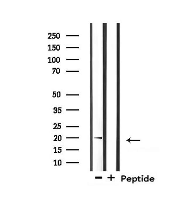 Mammaglobin A Antibody in Western Blot (WB)