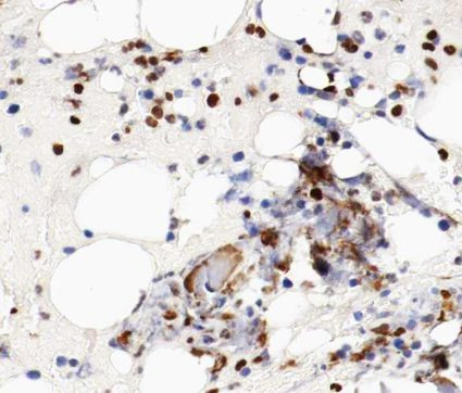 MCM5 Antibody in Immunohistochemistry (Paraffin) (IHC (P))