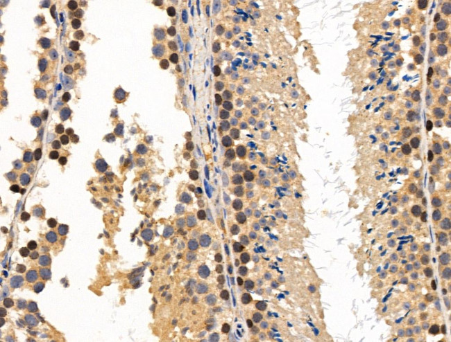 MCM5 Antibody in Immunohistochemistry (Paraffin) (IHC (P))