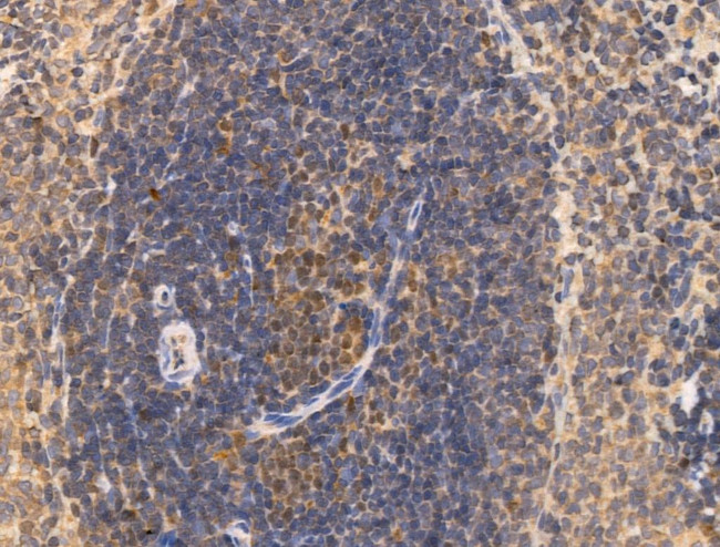 MCM5 Antibody in Immunohistochemistry (Paraffin) (IHC (P))