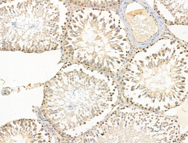 MCM5 Antibody in Immunohistochemistry (Paraffin) (IHC (P))