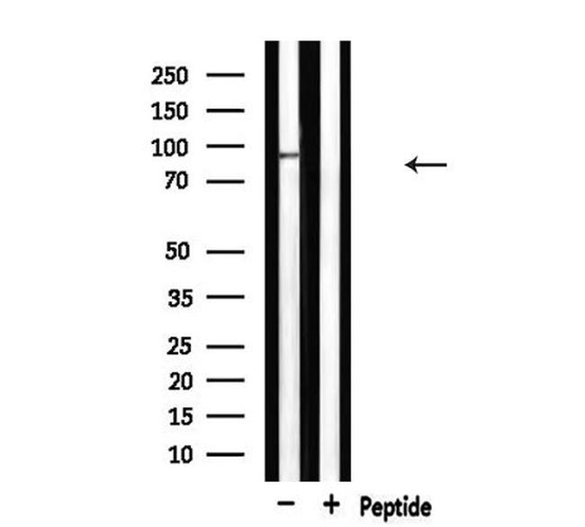 MCM5 Antibody in Western Blot (WB)